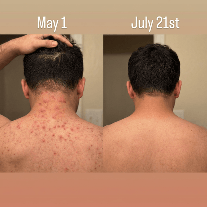 PureGlow™ Electric Exfoliating Brush