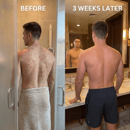 PureGlow™ Electric Exfoliating Brush